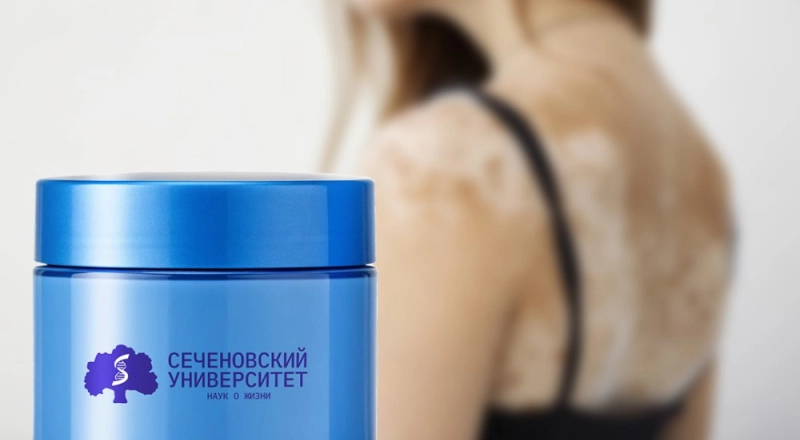 В Сеченовском Университете создали крем от витилиго