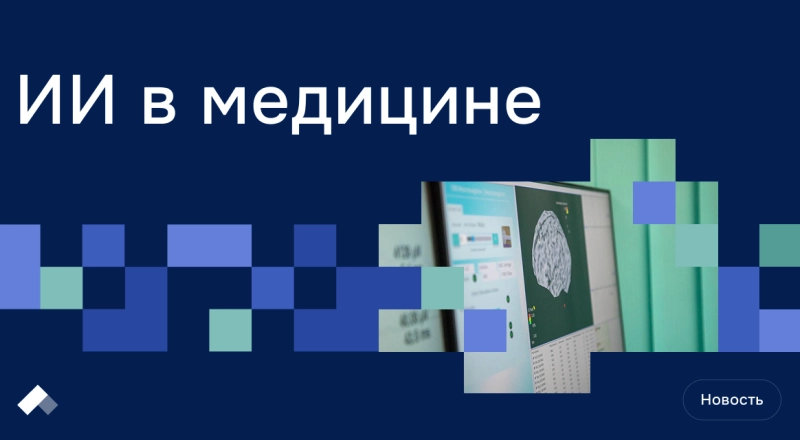 Ученые БФУ им. И. Канта научились прогнозировать восстановление пациентов после инсульта