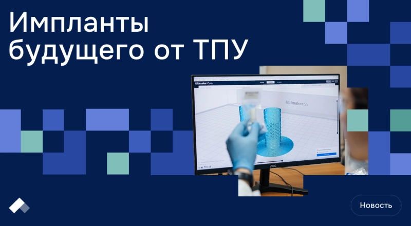 Ученые разработали полный цикл создания биодеградируемых имплантатов — их применяют в Центре Илизарова