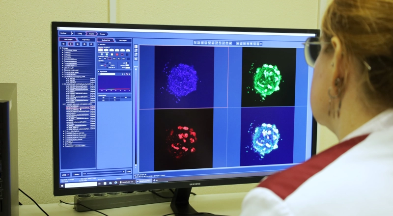 Отследить и обезвредить: в СибГМУ создали 3D-модель, которая отслеживает эффективность лекарств против метастазов